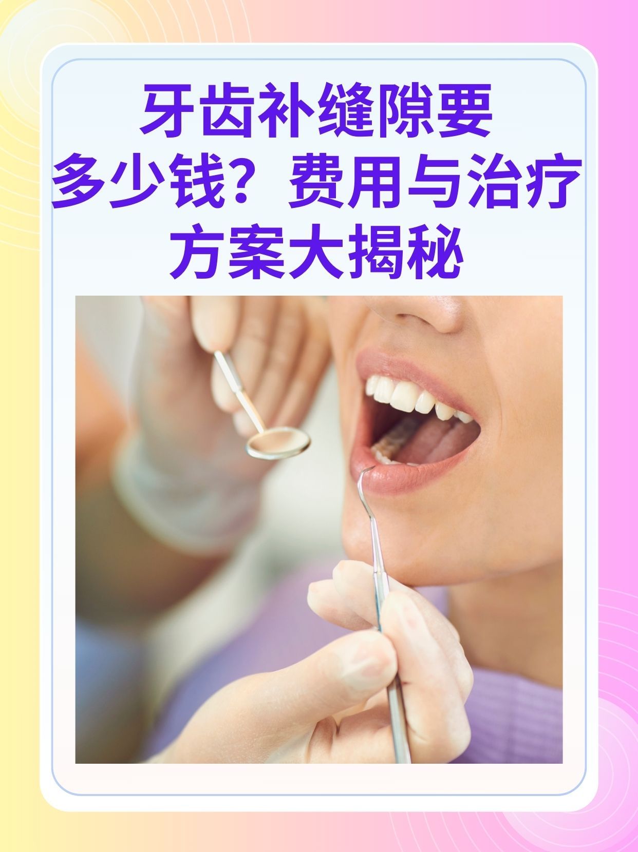 宿迁补牙医保可以报销吗(补牙医保可以报销吗 哪些可以报销呢)